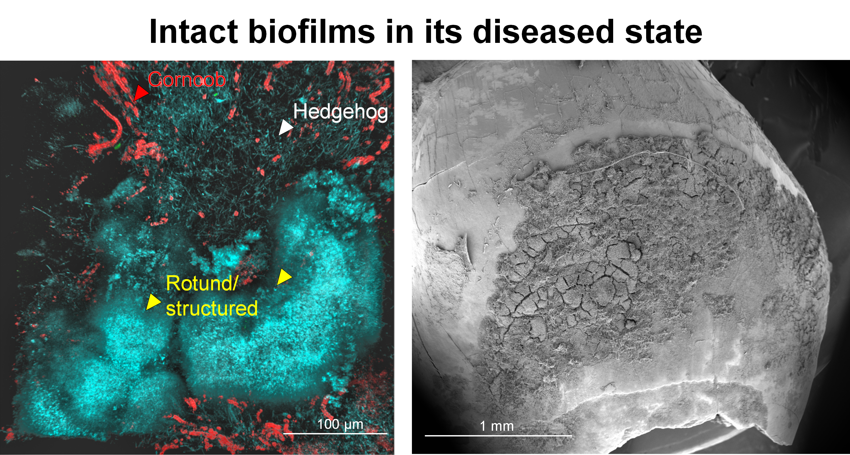 Intact biofilms in its diseased state