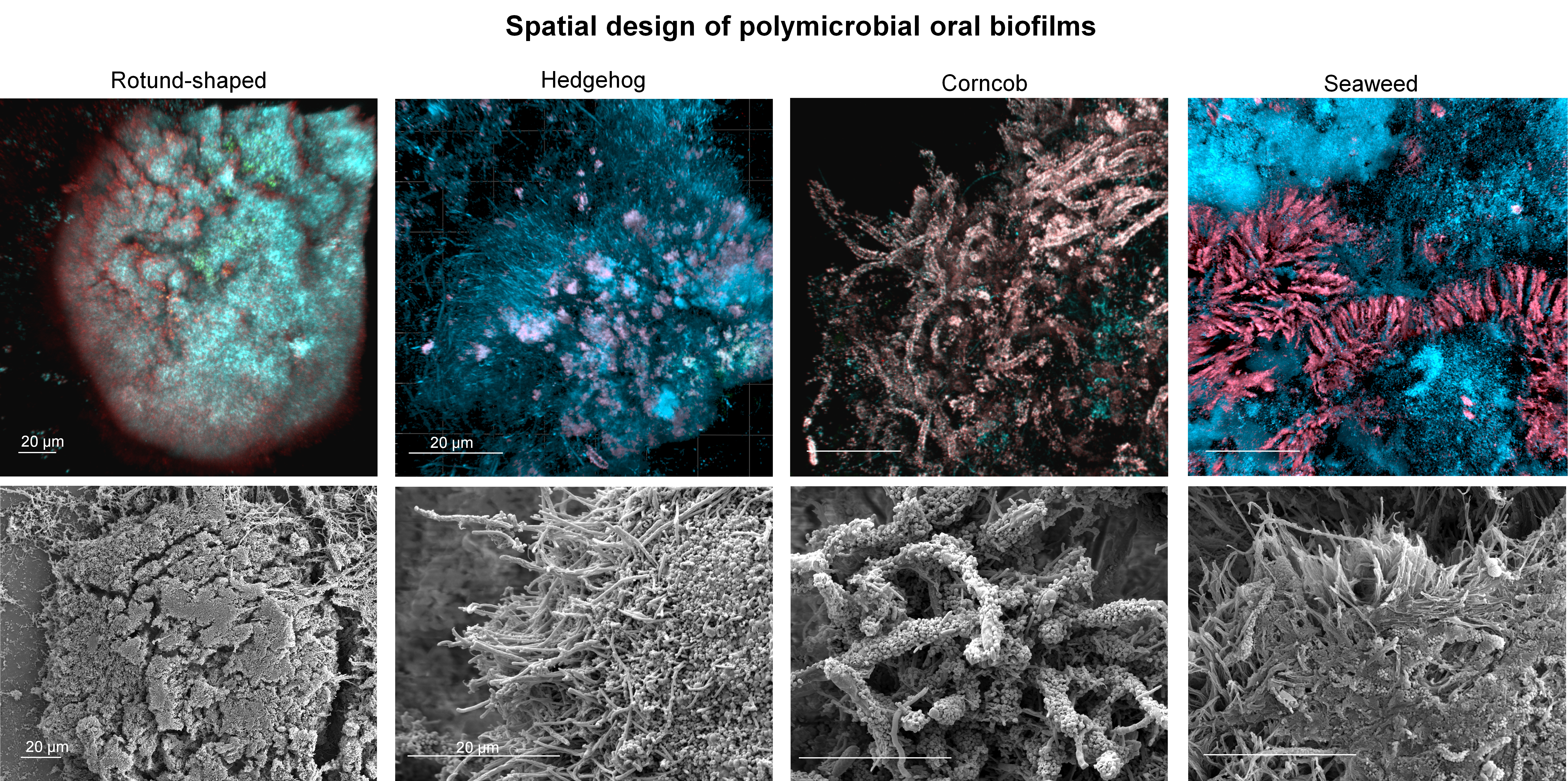 spatial design of polymicrobial oral biofilms