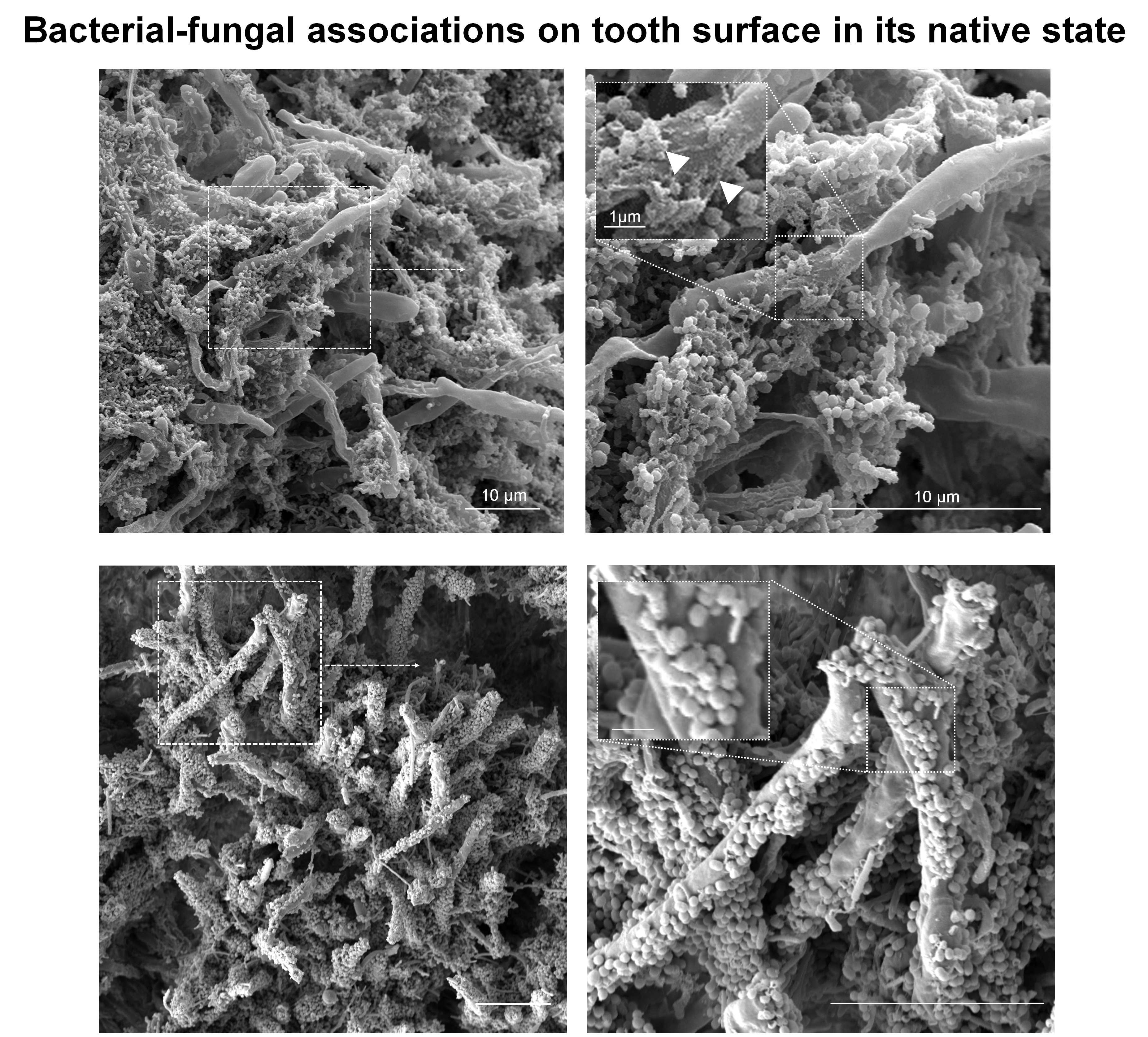 Bacterial-fugnal associates on tooth surface in ints native state