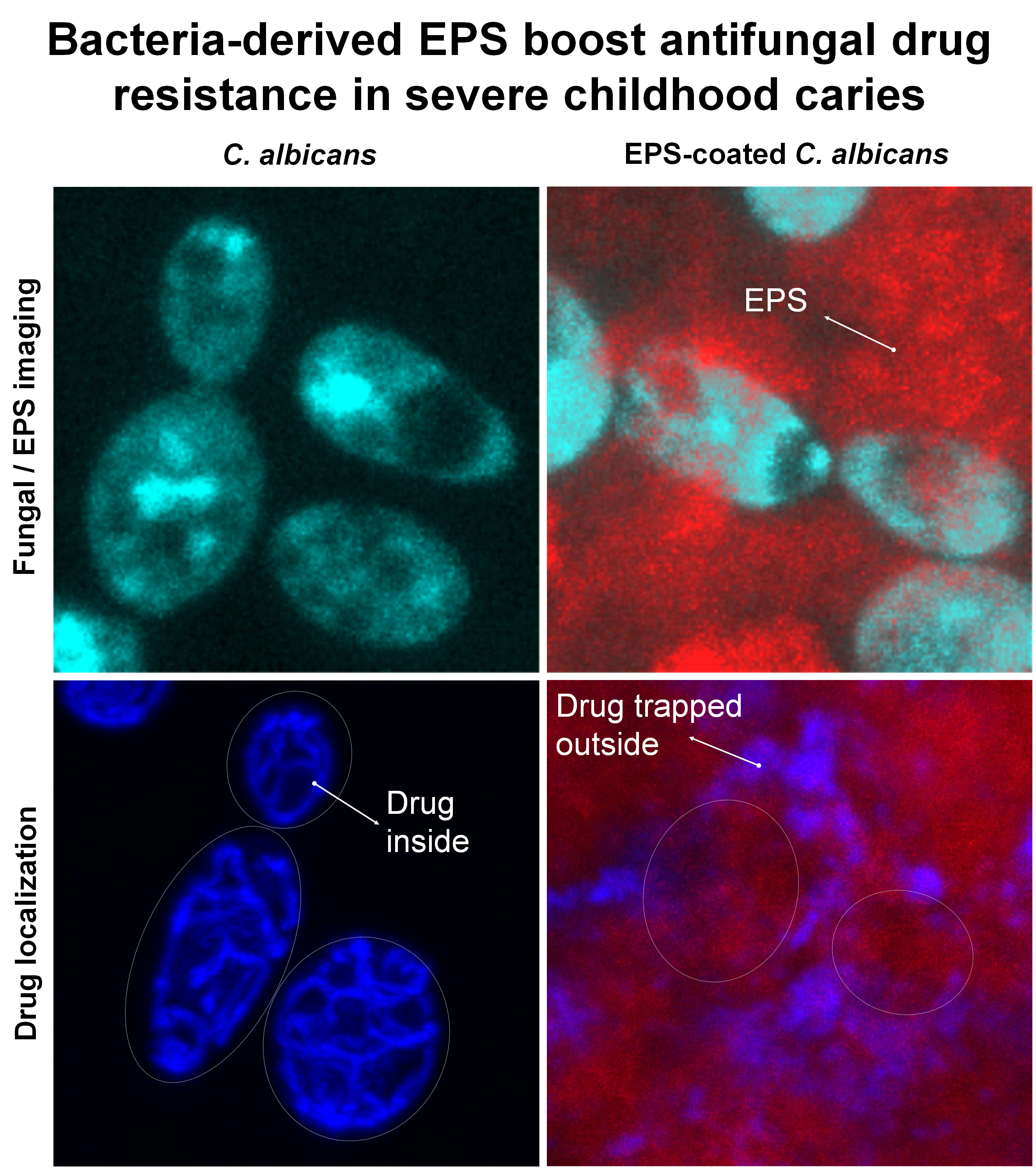 Bacteria-derived EPS boost antifungal drug resistance in severe childhood caries